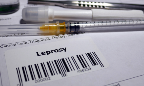leprosy
